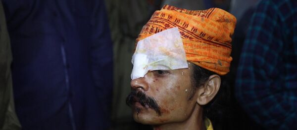 В Индии люди обращались в больницу после фестиваля метания камней - Sputnik Казахстан