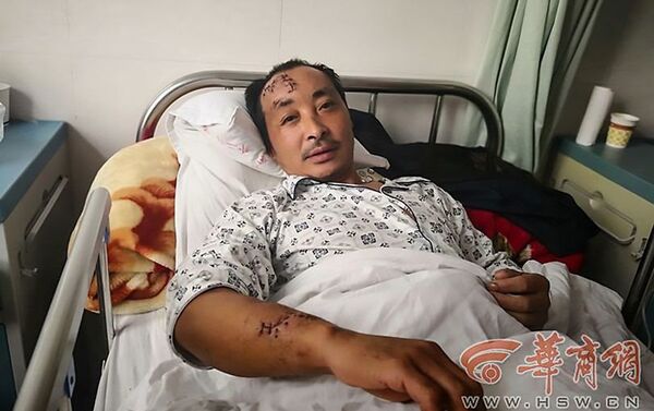 Спасаясь от медведя, китаец спрыгнул с обрыва: жуткие фото выжившего - Sputnik Казахстан