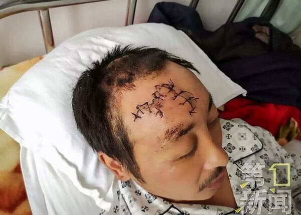 Спасаясь от медведя, китаец спрыгнул с обрыва: жуткие фото выжившего - Sputnik Казахстан