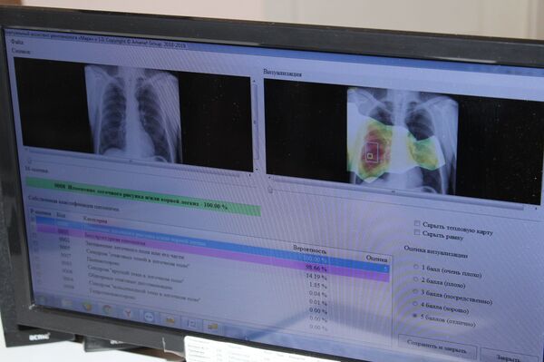 Как искусственный интеллект выявляет болезни легких на севере Казахстана - Sputnik Казахстан