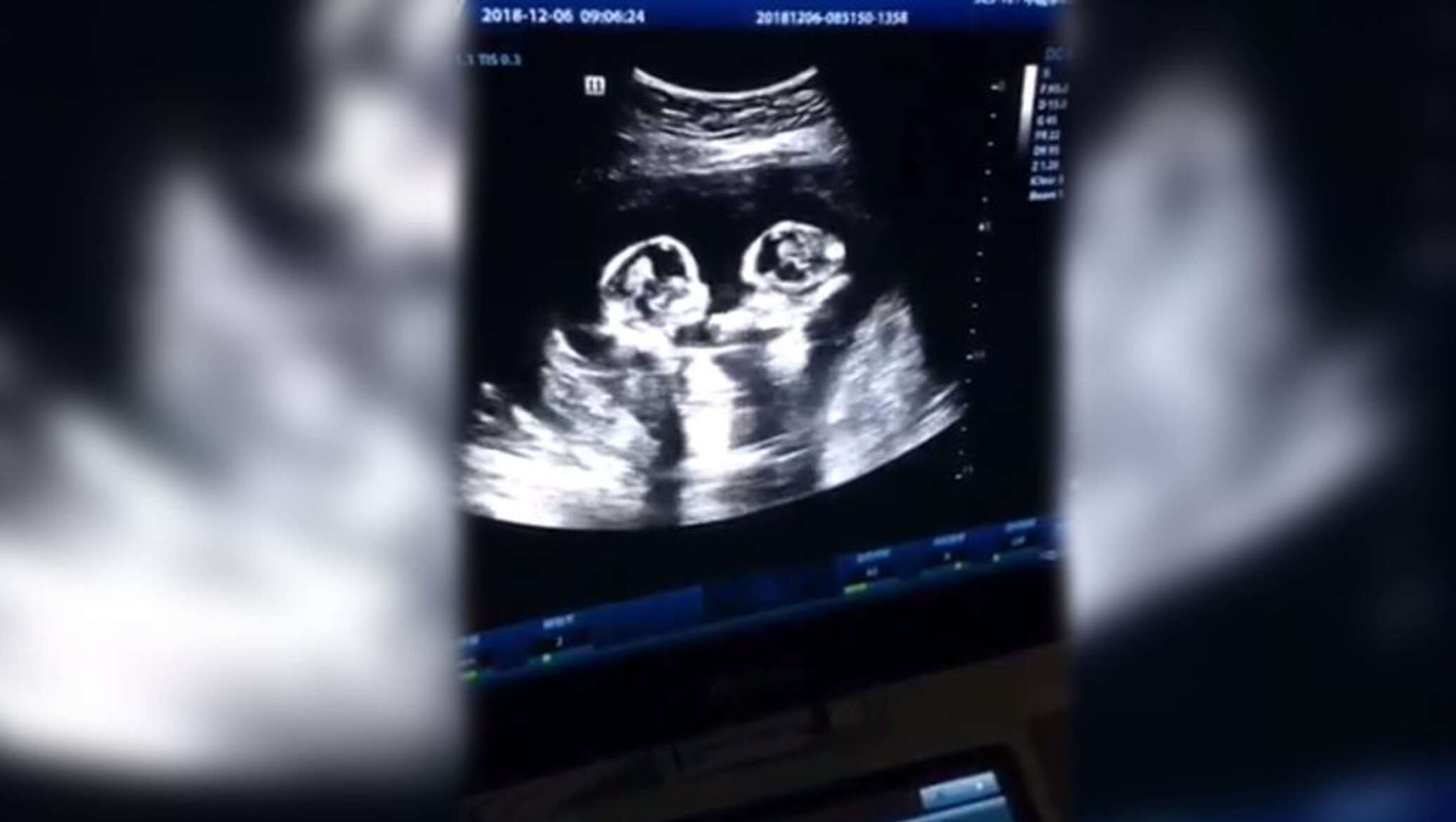 Сүт клизмасы порно