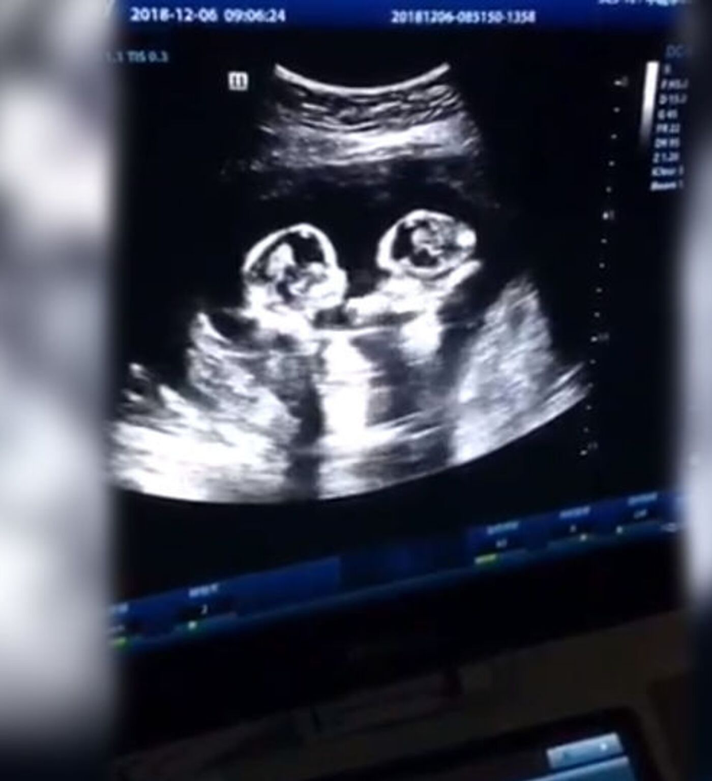 Американдық сұлулық эротикалық көріністері